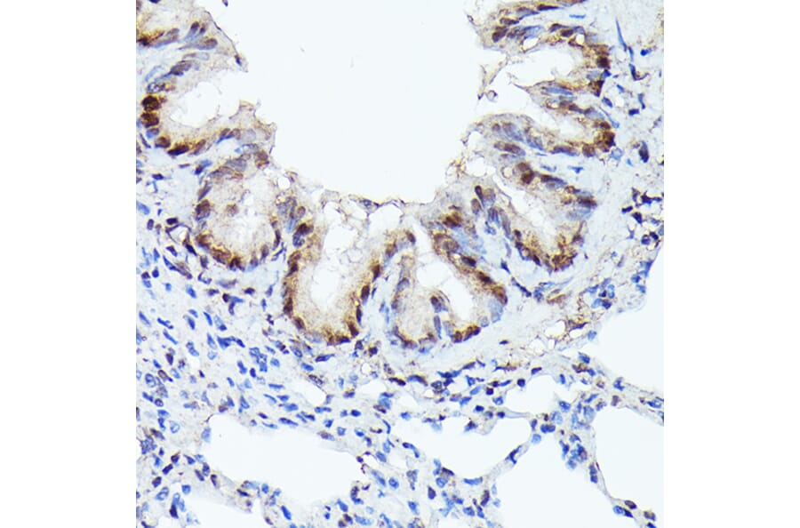 Immunohistochemistry - Anti-Cdk4 Antibody [ARC51004] (A81170) - Antibodies.com