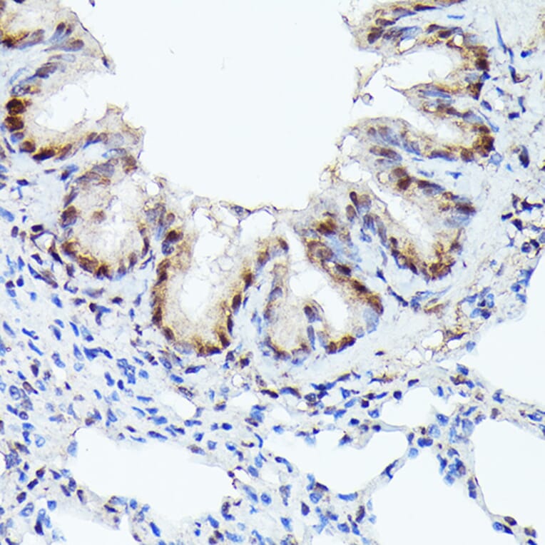 Immunohistochemistry - Anti-Cdk4 Antibody [ARC51004] (A81170) - Antibodies.com