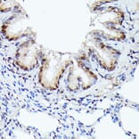 Immunohistochemistry - Anti-Cdk4 Antibody [ARC51004] (A81170) - Antibodies.com