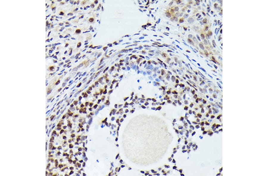 Immunohistochemistry - Anti-Cdk4 Antibody [ARC51004] (A81170) - Antibodies.com
