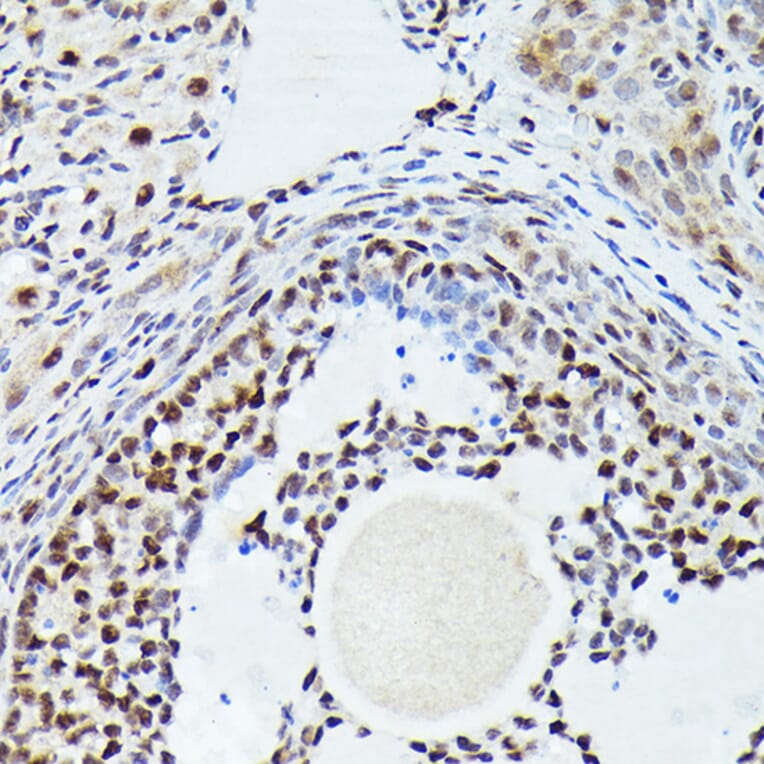 Immunohistochemistry - Anti-Cdk4 Antibody (A81170) - Antibodies.com