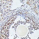 Immunohistochemistry - Anti-Cdk4 Antibody (A81170) - Antibodies.com