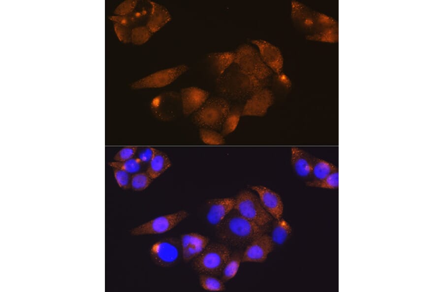 Immunofluorescence - Anti-Cdk4 Antibody (A81170) - Antibodies.com