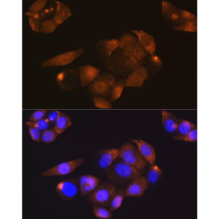 Immunofluorescence - Anti-Cdk4 Antibody (A81170) - Antibodies.com
