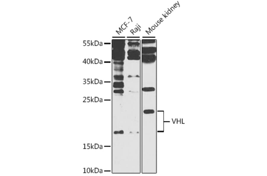 Western Blot - Anti-Von Hippel Lindau / VHL Antibody (A81172) - Antibodies.com