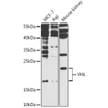 Western Blot - Anti-Von Hippel Lindau / VHL Antibody (A81172) - Antibodies.com