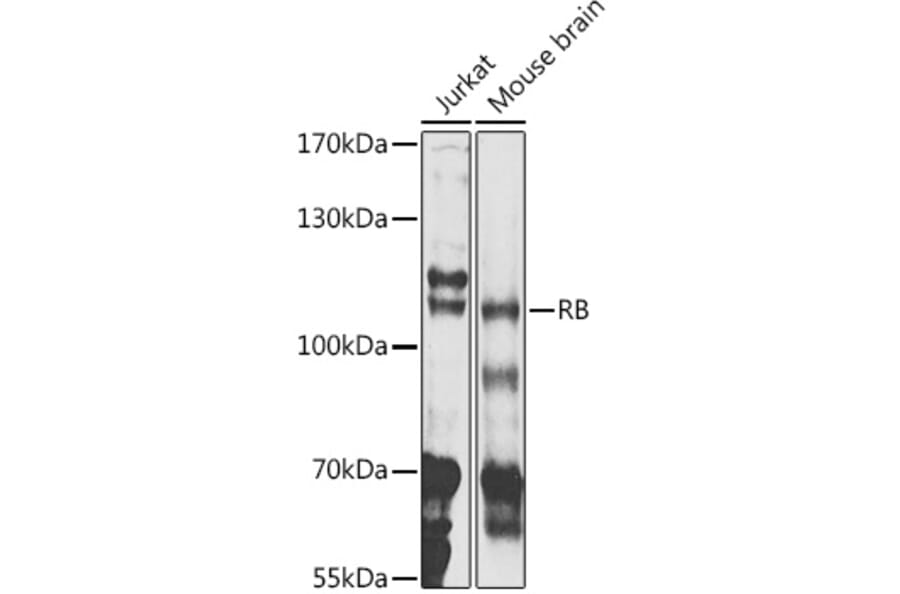 Western Blot - Anti-Rb Antibody (A81175) - Antibodies.com