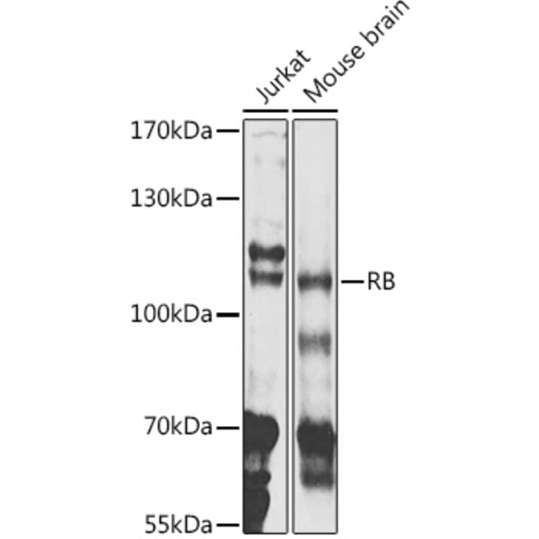 Western Blot - Anti-Rb Antibody (A81175) - Antibodies.com