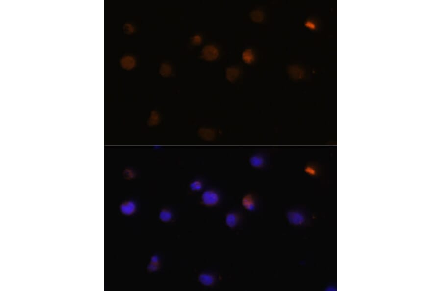 Immunofluorescence - Anti-Rb Antibody (A81175) - Antibodies.com