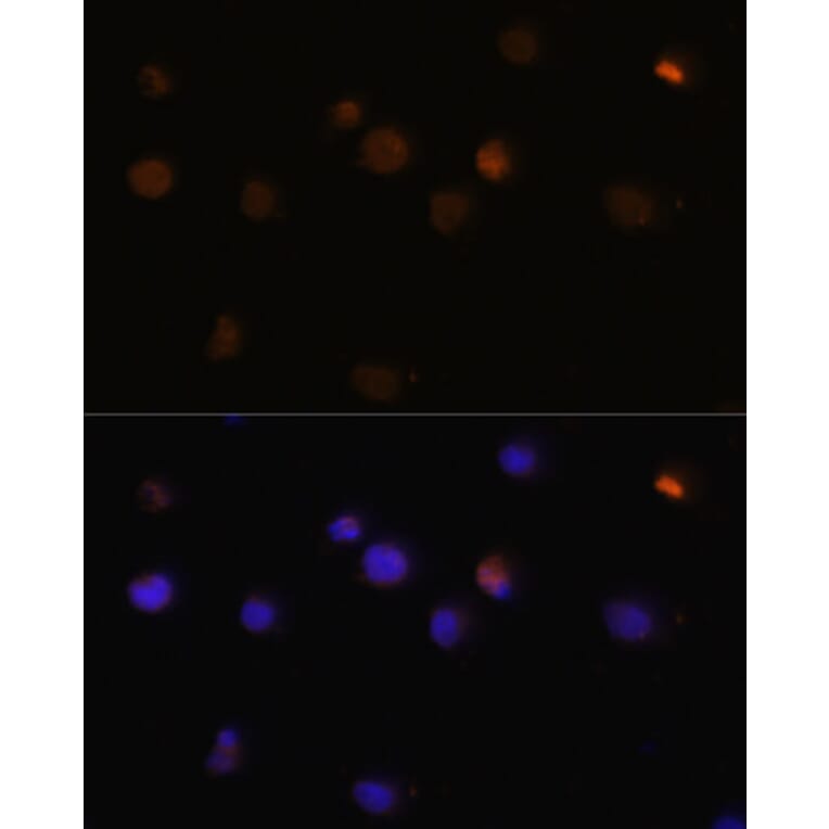 Immunofluorescence - Anti-Rb Antibody (A81175) - Antibodies.com