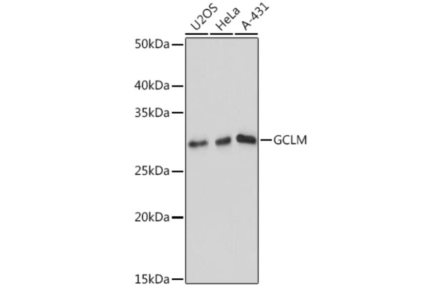 Western Blot - Anti-GCLM Antibody [ARC0597] (A81176) - Antibodies.com