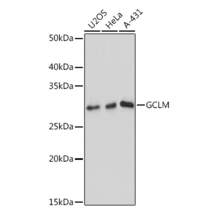 Western Blot - Anti-GCLM Antibody [ARC0597] (A81176) - Antibodies.com