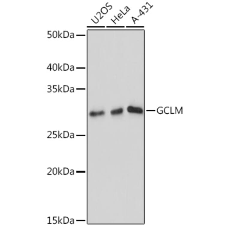 Western Blot - Anti-GCLM Antibody [ARC0597] (A81176) - Antibodies.com