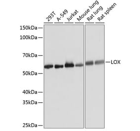 Western Blot - Anti-LOX Antibody [ARC0624] (A81177) - Antibodies.com