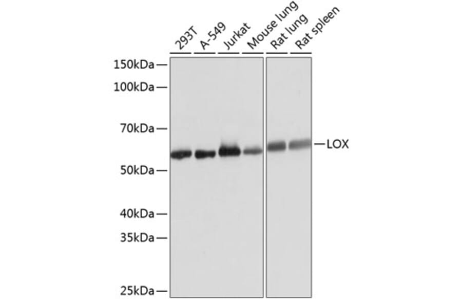 Western Blot - Anti-LOX Antibody [ARC0624] (A81177) - Antibodies.com
