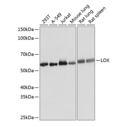 Western Blot - Anti-LOX Antibody [ARC0624] (A81177) - Antibodies.com