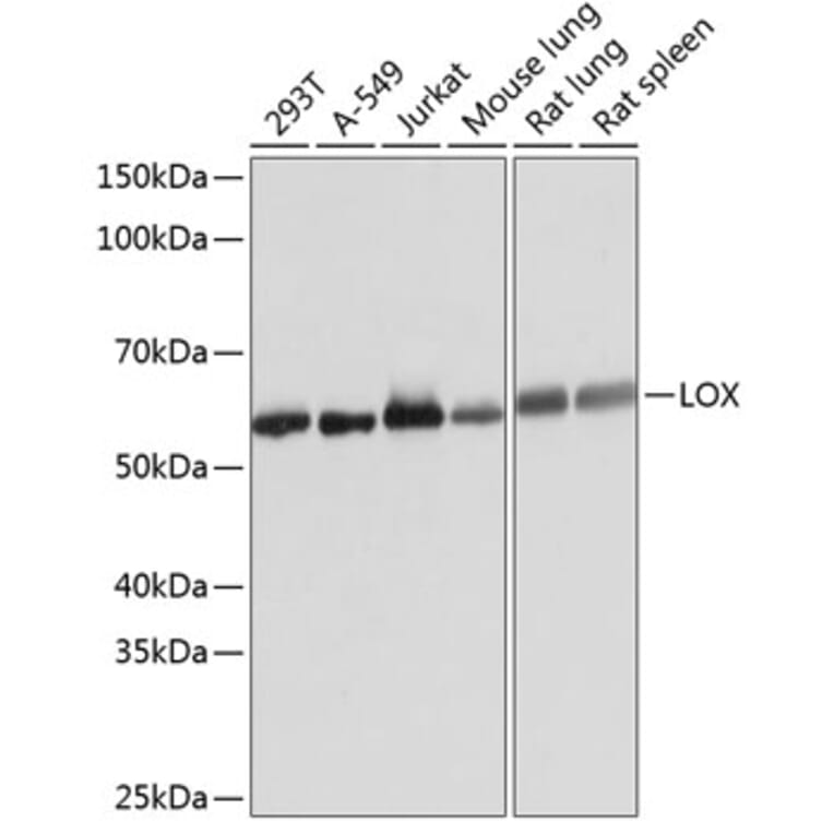 Western Blot - Anti-LOX Antibody [ARC0624] (A81177) - Antibodies.com