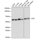 Western Blot - Anti-LOX Antibody [ARC0624] (A81177) - Antibodies.com