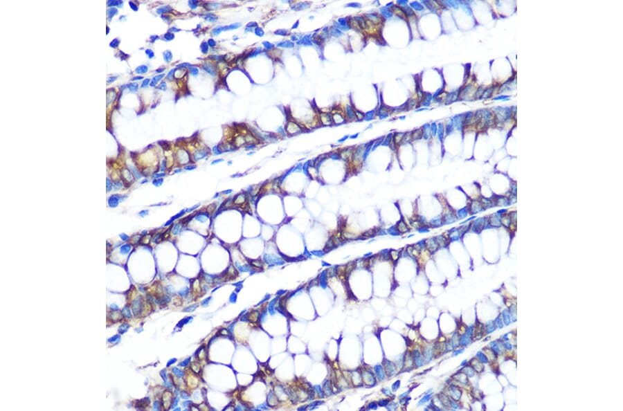 Immunohistochemistry - Anti-LOX Antibody [ARC0624] (A81177) - Antibodies.com