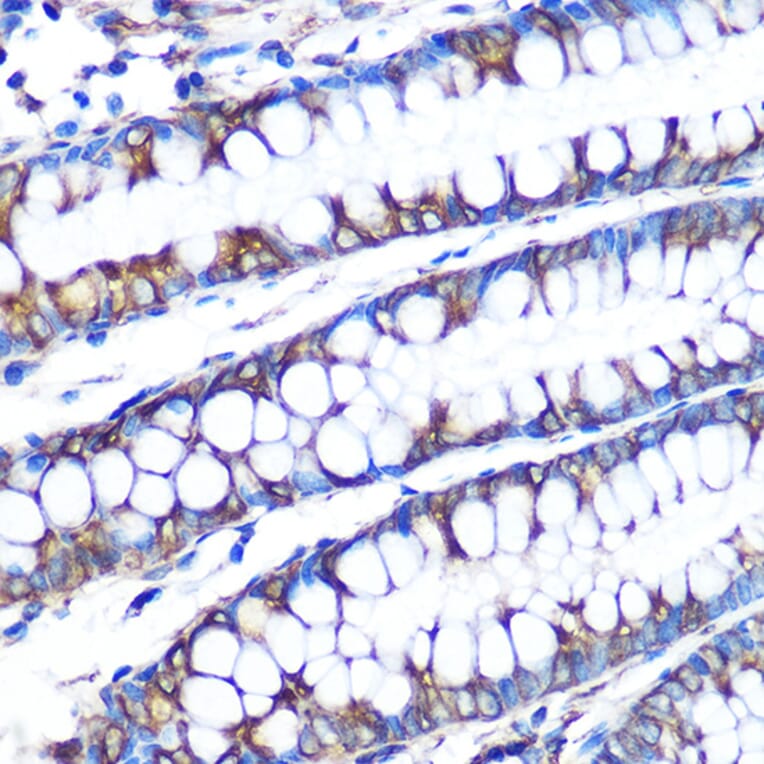Immunohistochemistry - Anti-LOX Antibody [ARC0624] (A81177) - Antibodies.com