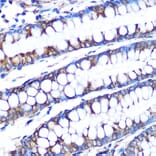 Immunohistochemistry - Anti-LOX Antibody [ARC0624] (A81177) - Antibodies.com