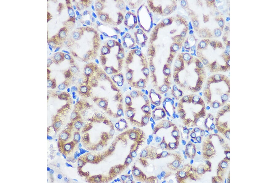 Immunohistochemistry - Anti-LOX Antibody [ARC0624] (A81177) - Antibodies.com