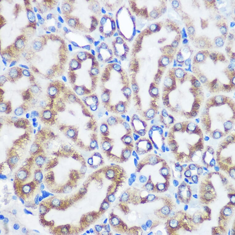 Immunohistochemistry - Anti-LOX Antibody [ARC0624] (A81177) - Antibodies.com