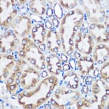 Immunohistochemistry - Anti-LOX Antibody [ARC0624] (A81177) - Antibodies.com