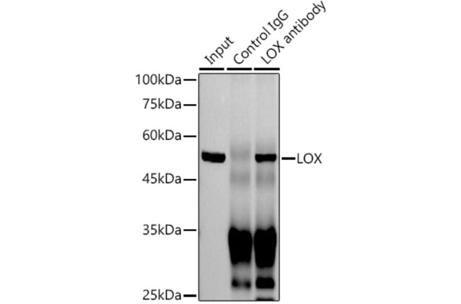 Western Blot - Anti-LOX Antibody [ARC0624] (A81177) - Antibodies.com