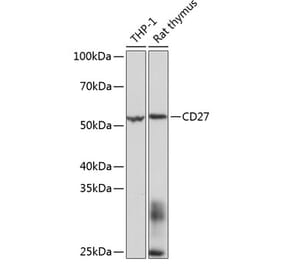 Western Blot - Anti-CD27 Antibody [ARC0625] (A81178) - Antibodies.com