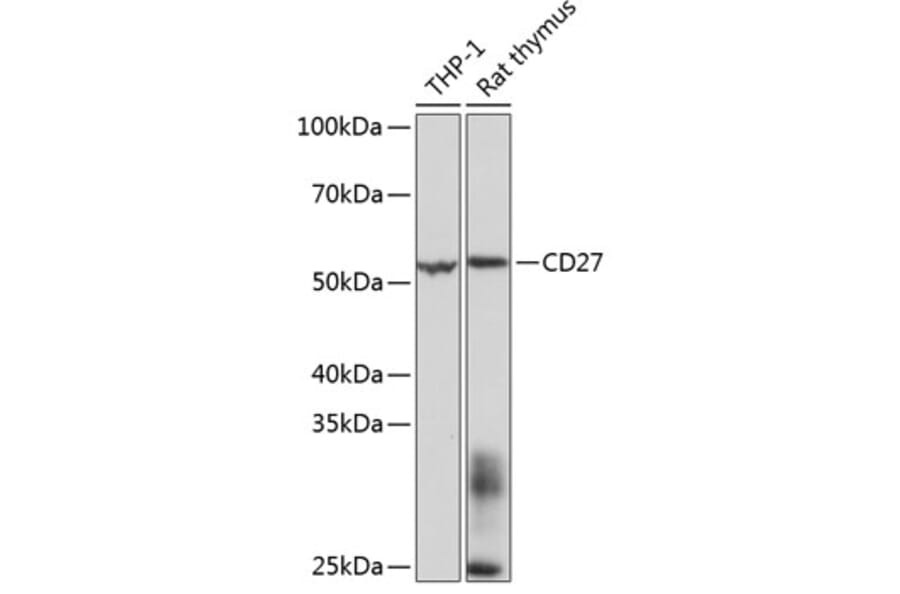Western Blot - Anti-CD27 Antibody [ARC0625] (A81178) - Antibodies.com