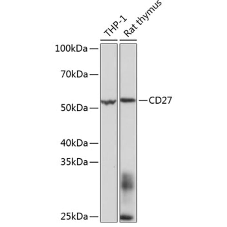 Western Blot - Anti-CD27 Antibody [ARC0625] (A81178) - Antibodies.com