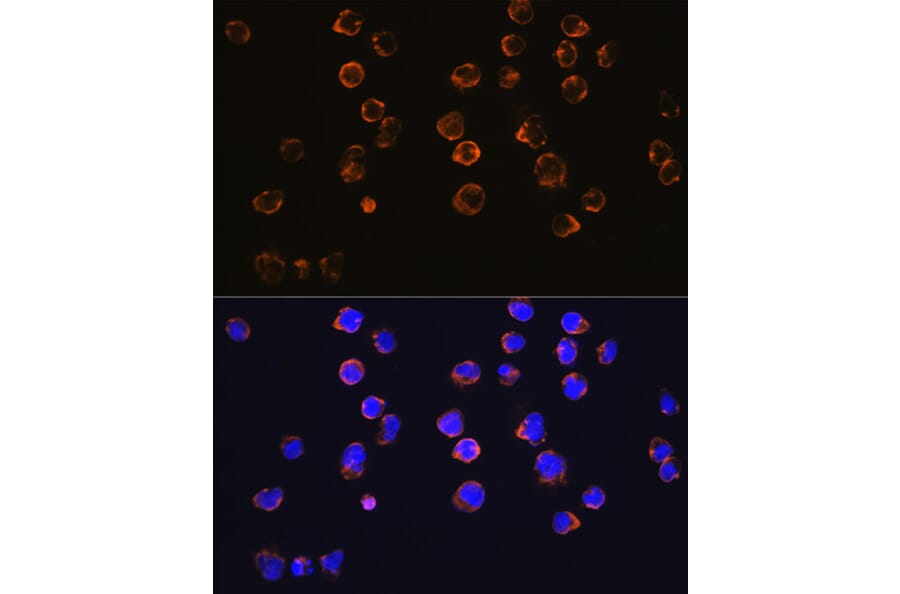Immunofluorescence - Anti-CD27 Antibody [ARC0625] (A81178) - Antibodies.com