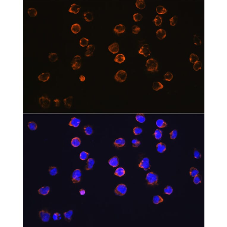 Immunofluorescence - Anti-CD27 Antibody [ARC0625] (A81178) - Antibodies.com