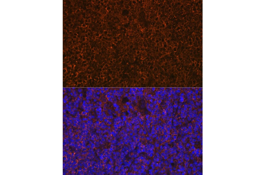Immunofluorescence - Anti-CD27 Antibody [ARC0625] (A81178) - Antibodies.com