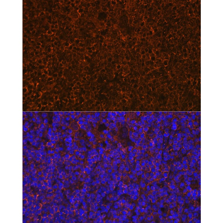 Immunofluorescence - Anti-CD27 Antibody [ARC0625] (A81178) - Antibodies.com