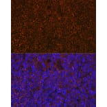 Immunofluorescence - Anti-CD27 Antibody [ARC0625] (A81178) - Antibodies.com