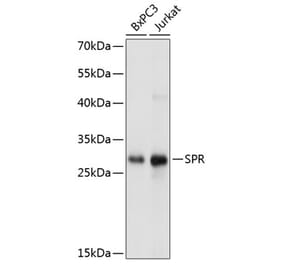 Western Blot - Anti-SPR Antibody (A81181) - Antibodies.com
