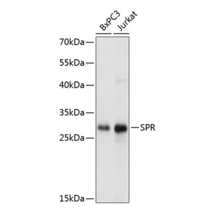 Western Blot - Anti-SPR Antibody (A81181) - Antibodies.com