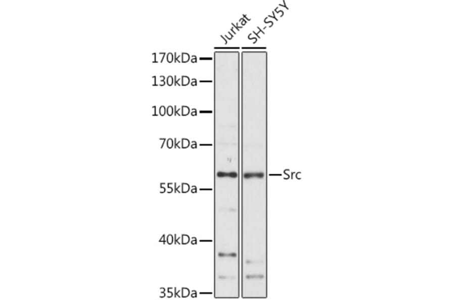 Western Blot - Anti-Src Antibody (A81182) - Antibodies.com