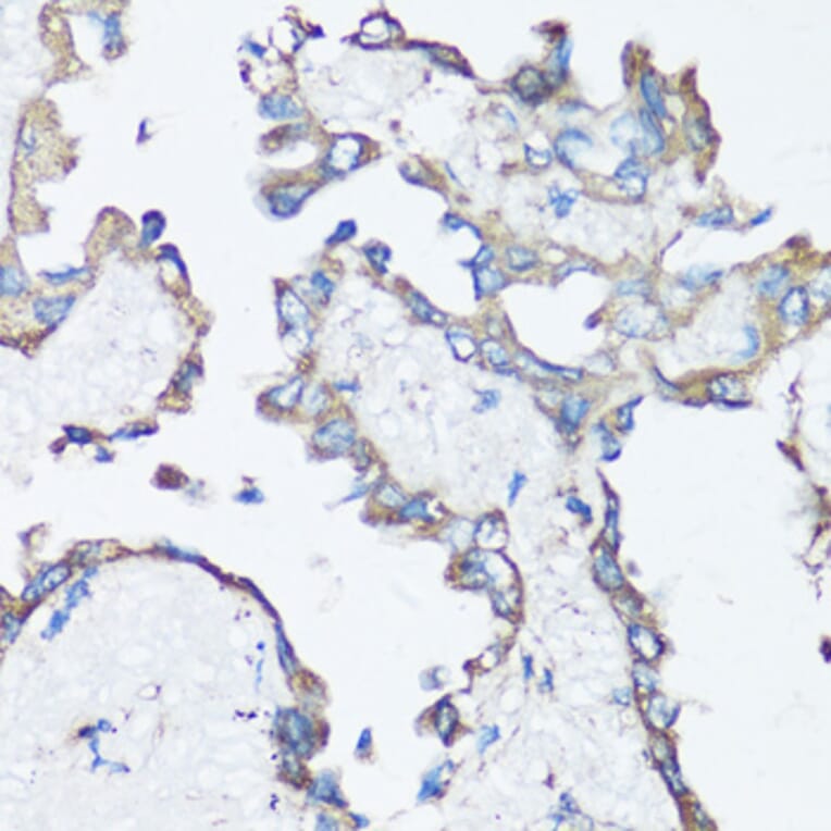 Immunohistochemistry - Anti-Src Antibody (A81182) - Antibodies.com