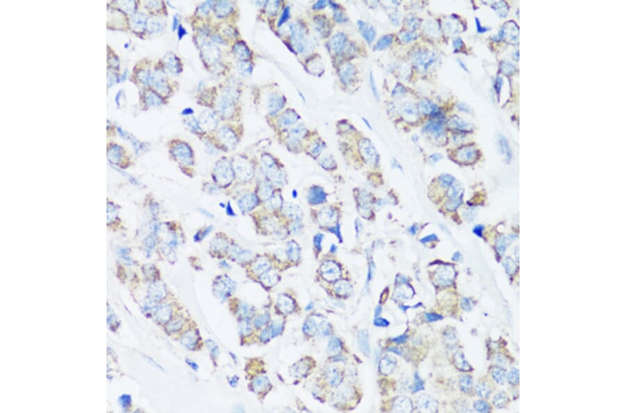 Immunohistochemistry - Anti-Src Antibody (A81182) - Antibodies.com
