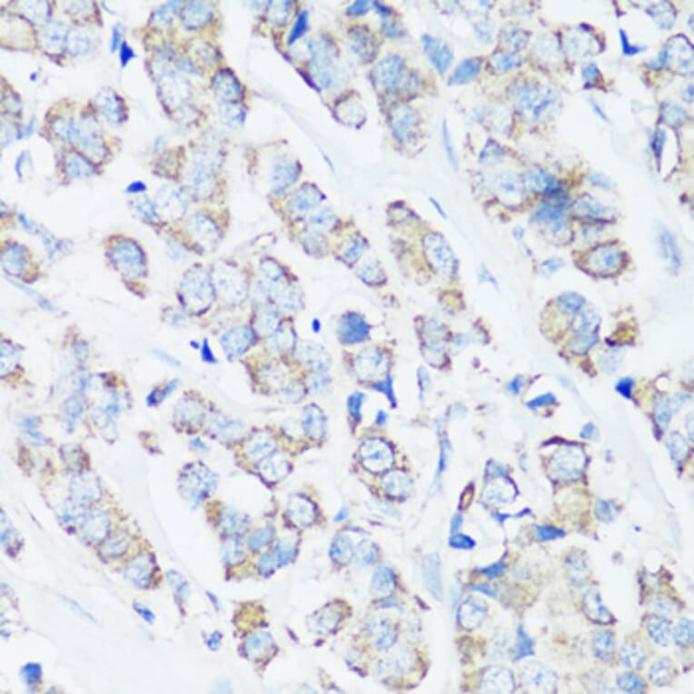 Immunohistochemistry - Anti-Src Antibody (A81182) - Antibodies.com