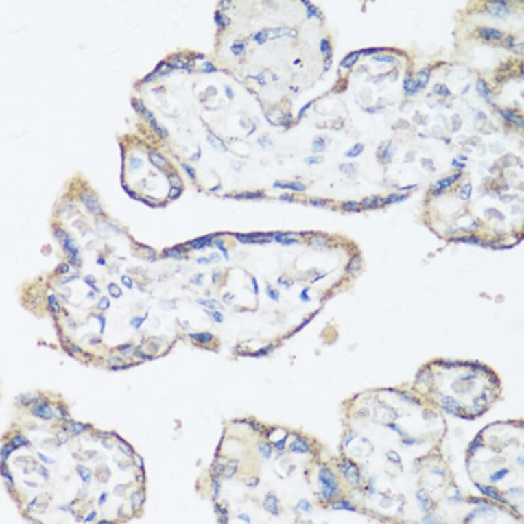Immunohistochemistry - Anti-Src Antibody (A81182) - Antibodies.com