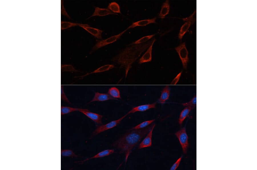 Immunofluorescence - Anti-Src Antibody (A81182) - Antibodies.com