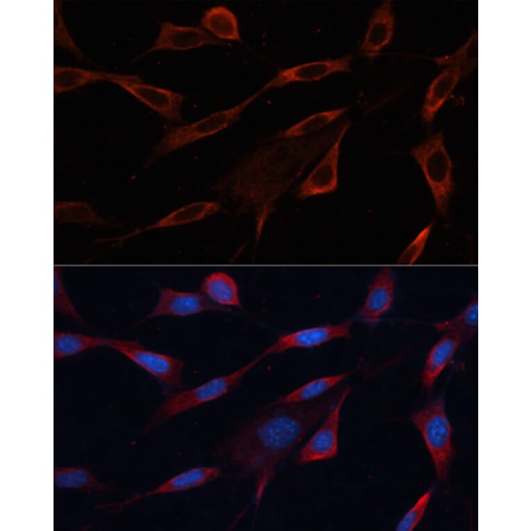 Immunofluorescence - Anti-Src Antibody (A81182) - Antibodies.com
