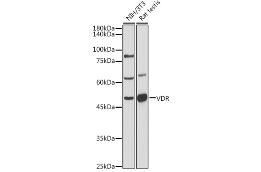 Western Blot - Anti-Vitamin D Receptor Antibody (A81184) - Antibodies.com