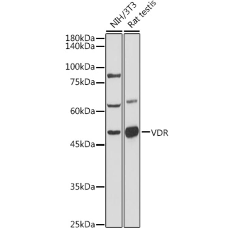 Western Blot - Anti-Vitamin D Receptor Antibody (A81184) - Antibodies.com