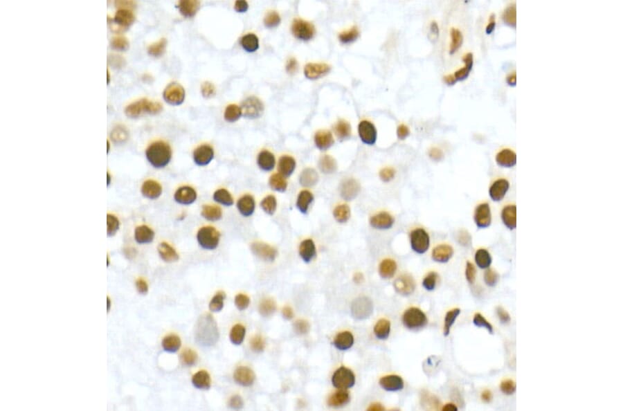 Immunohistochemistry - Anti-Vitamin D Receptor Antibody (A81184) - Antibodies.com
