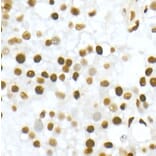 Immunohistochemistry - Anti-Vitamin D Receptor Antibody (A81184) - Antibodies.com